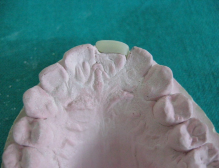 Ceramic laminate fabrication stage 1