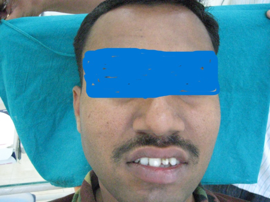 Before treatment dental condition